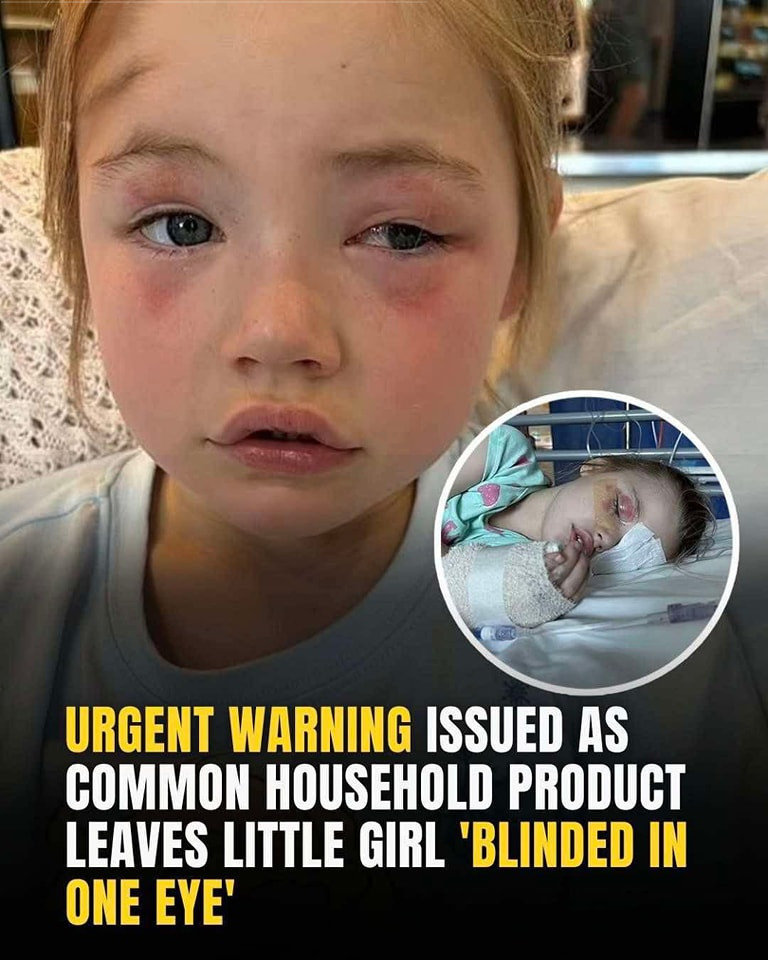 Urgent Warning After 4-Year-Old Girl Left Partially Blind by Common Laundry Product