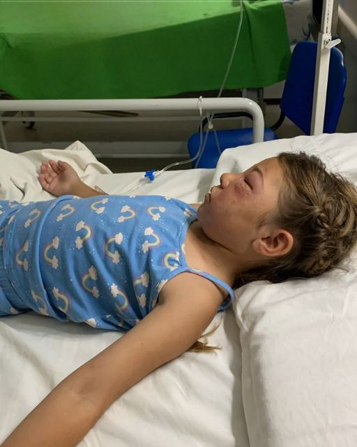 My Daughter Woke From a Coma After a Bee Sting—But What She Said First Left Me Terrified