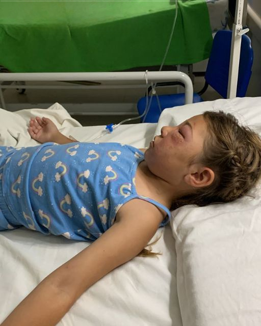 MY DAUGHTER SURVIVED A COMA AFTER A BEE STING—BUT HER FIRST WORDS TERRIFIED ME