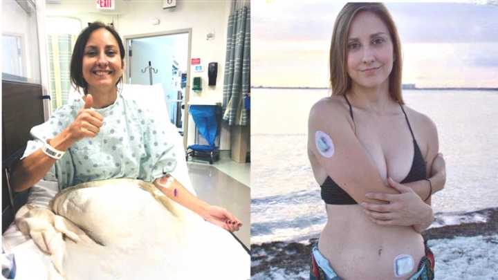 People Said I Couldn’t Be Diabetic—But I Was: Girl’s Type 1 Diagnosis After Years of Symptoms