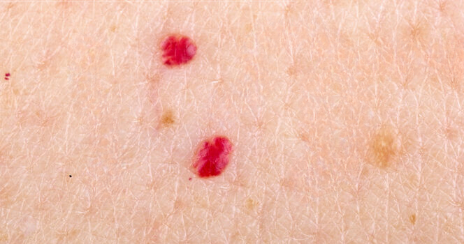 Credit / Shutterstock